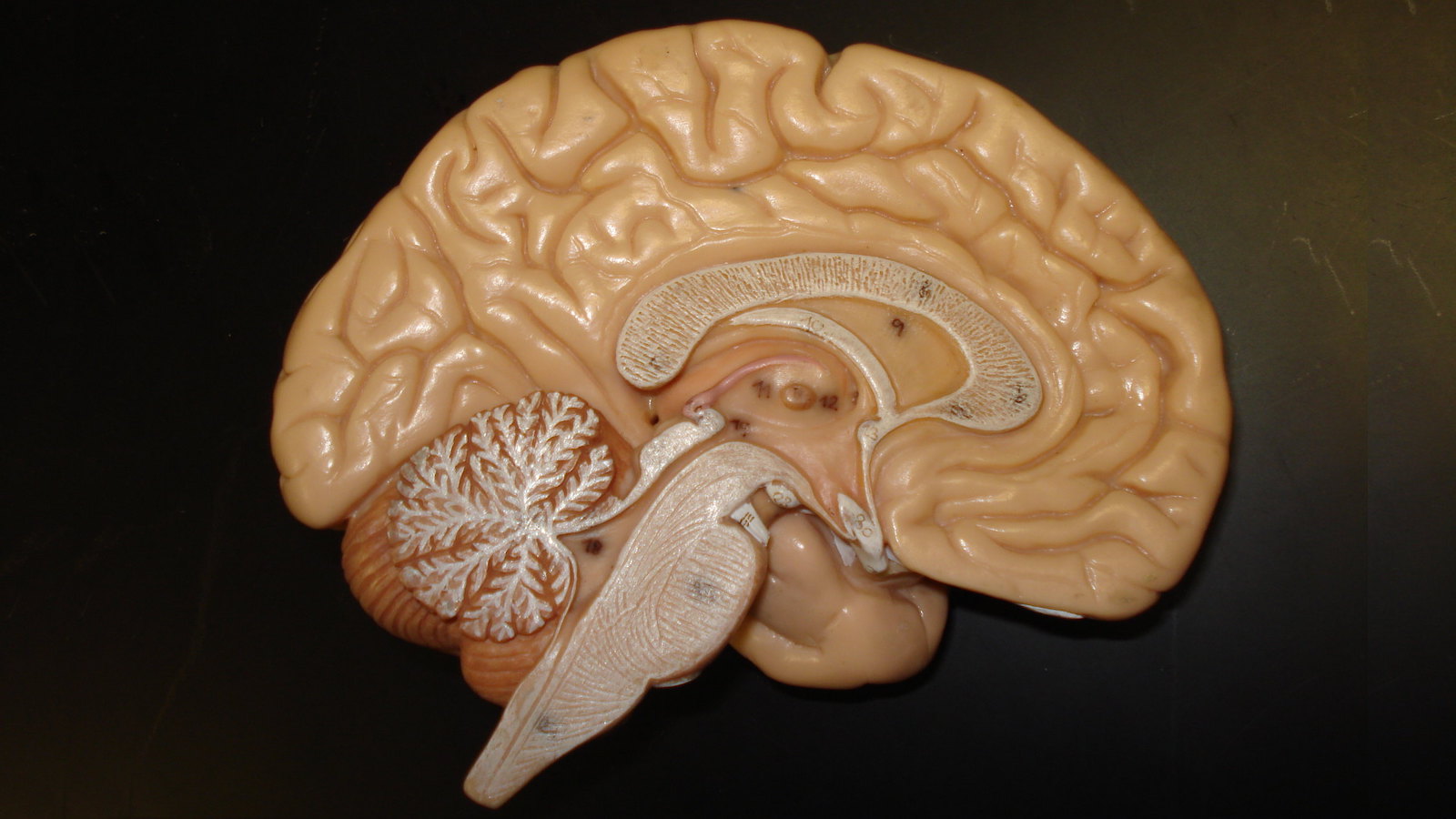 Los ultraprocesados alteran funciones de tu cerebro