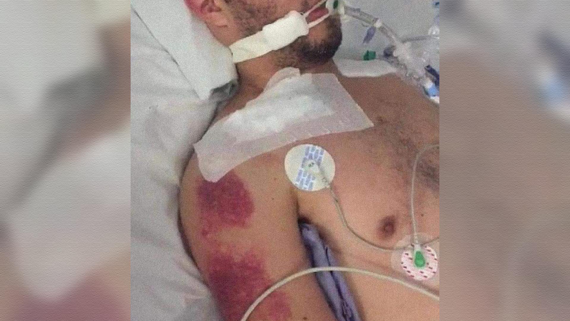 Con golpes y descargas, policías de León dejan a joven al borde de la muerte